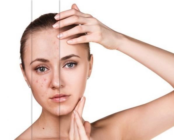 لتهابات البشرة