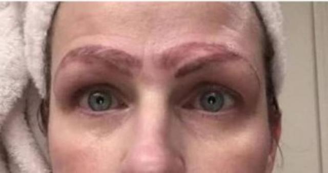 السيدة بعد عملية التجميل