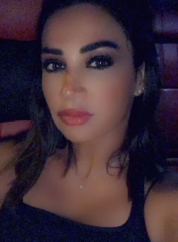صور ديانا حداد تشعل إنستجرام بـ البوتكس والشفاه المنتفخة فنون خط أحمر