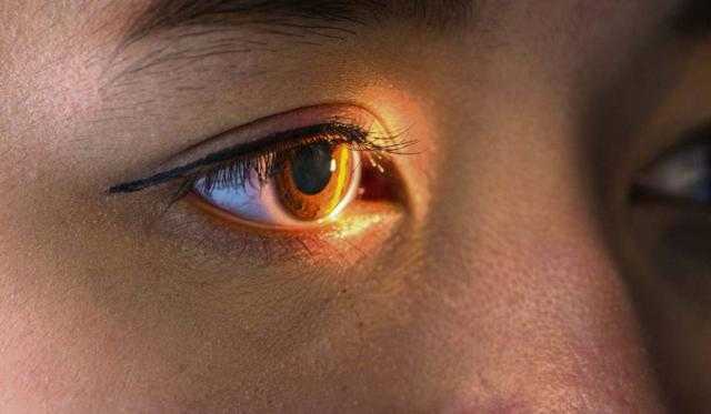 احترس منها .. 10 أمراض تسبب العمى فى مختلف الأعمار