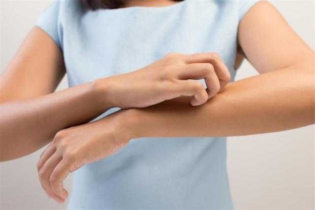 6 أسباب تعرضك للحكة بعد الإستحمام