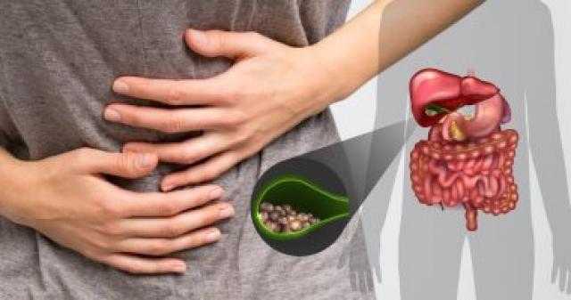 دراسة طبية تحذر من تأخير التدخل الجراحى في حالات التهاب المرارة