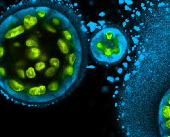 كورونا حول العالم: إجمالي الإصابات 179.1 مليونا.. وإعطاء 2.71 مليار جرعة لقاح