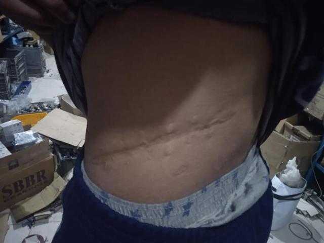 أحد أيتام دار مكة المكرمة بالشرقية يروي تفاصيل سرقة كليته