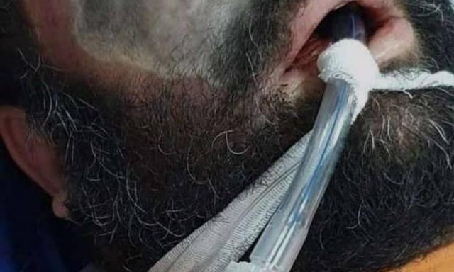 الفطر الأسود