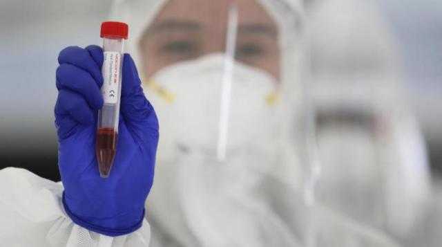 فرنسا: إعطاء 48.9 مليون جرعة من لقاحات كورونا حتى الآن