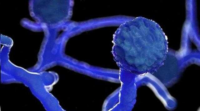 مشفى دمشق يستقبل 17 حالة جديدة مصابة بالفطر الأسود