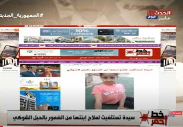 ”جودي”.. مأساة طفلة تعاني من ضمور النخاع الشوكي.. فيديو