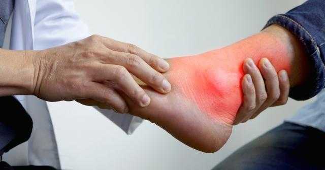 أعراض النقرس فى القدم وكيفية العلاج منه