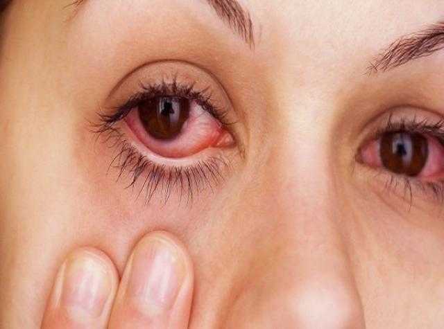 لماذا يصاب الأطفال باحمرار في العين مع ارتفاع الحرارة.. اعرف التفاصيل