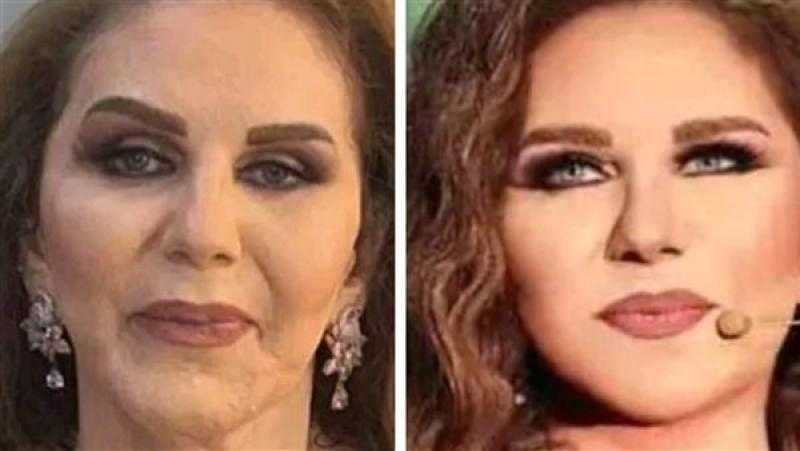 ورحمة أمي ما حصل.. ميادة الحناوي تكشف حقيقة خضوعها لعمليات تجميل