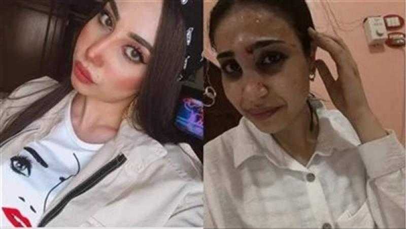 ياسمين عز معلقة على واقعة فتاة دكرنس: “ازاي تعمل محضر في والدها عشان ضربها؟”