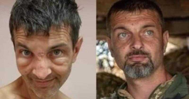 أوكرانيا تنشر صورة لأحد جنودها قبل وبعد وقوعه فى أسر القوات الروسية