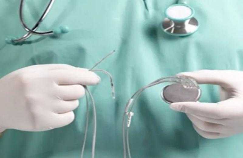تركيب 4 منظمات لضربات القلب لمرضى تحت مظلة التأمين الصحي في الأقصر