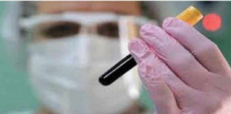 منها ضيق التنفس.. تعرف على أعراض نقص الحديد فى الجسم