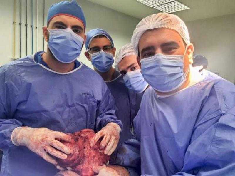 استئصال ورم يزن 4 كيلو من صدر مسن في المنوفية