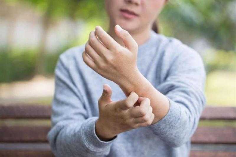 دراسة تكتشف ارتباط أمراض الجلد بمشكلات الصحة العقلية