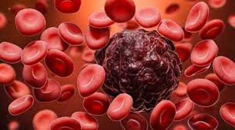 باحثون يتوصلون لطريقة جينية لعلاج سرطان الدم