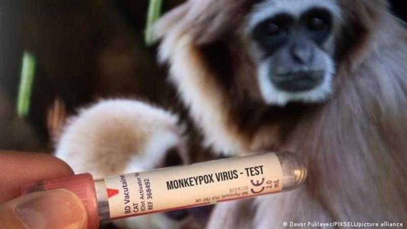 أمريكا: إنهاء حالة الطوارئ الخاصة بجدري القرود