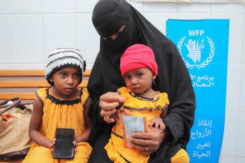 يونيسيف: وفاة 342 طفلا يمنيا بمرض الحصبة خلال ستة أشهر