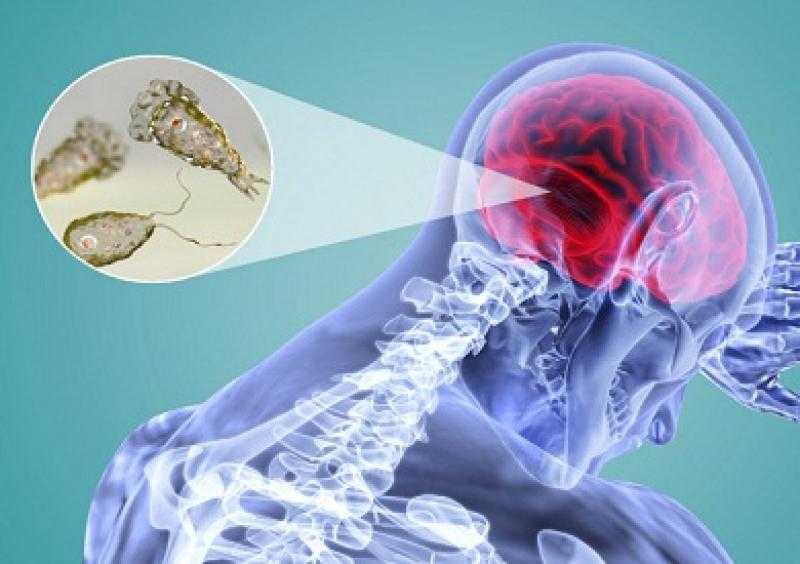 الصحة الماليزية: لم يتم الإبلاغ عن أي حالات إصابة بالأميبا آكلة الدماغ حتى الآن