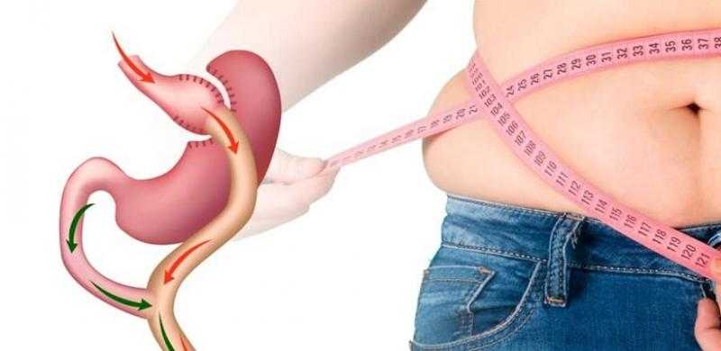 أضرار عملية تكميم المعدة.. تعرف عليها
