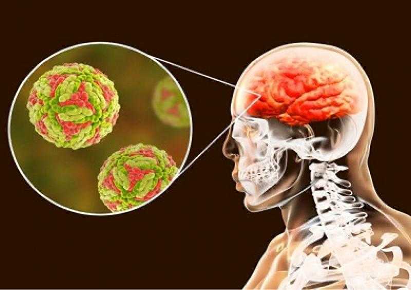 تسجيل أول حالة إصابة بالتهاب الدماغ الناجم عن لدغة القراد في بريطانيا