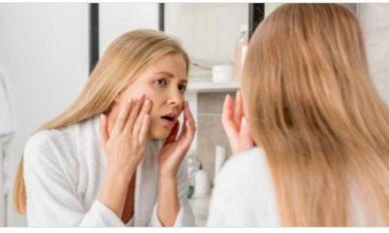 علاج تقشير الوجه عند وضع المكياج