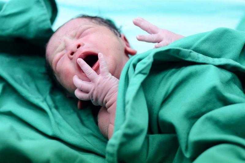 ولادة طفلة وزنها 350 جراماً فقط