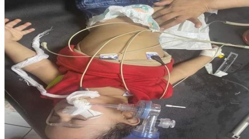 تفاصيل صادمة بشأن إنقاذ طفل رضيع ابتلع جسمًا غريبًا بمحافظة الغربية
