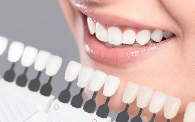 كل ما تود معرفته عن أنواع تجميل الأسنان
