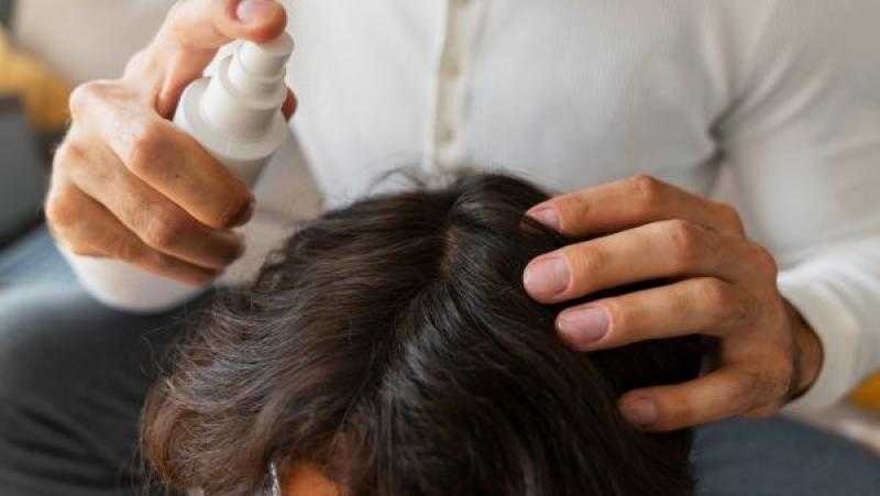 نصائح للاهتمام بفروة رأسك في الصيف