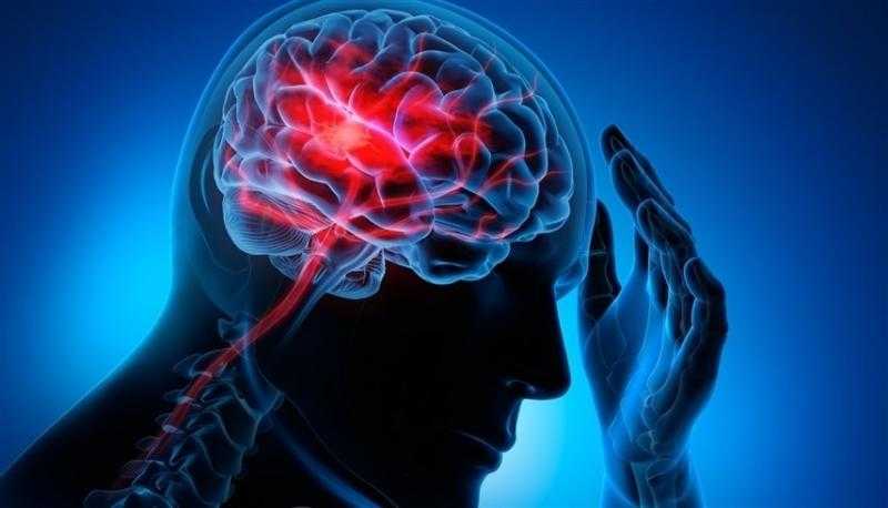 ما هو خثار الجيب الوريدي المخي؟.. الأسباب والأعراض