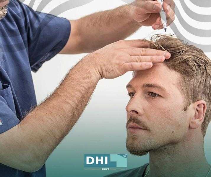 تجربتي مع زراعة الشعر