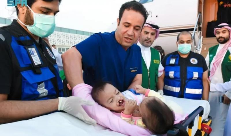 بدء عملية فصل التوأم السيامي الفلبيني “أكيزا وعائشة” بالرياض