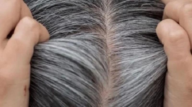 استعدى للعيد.. 4 طرق طبيعية للتخلص من الشعر الأبيض بدون حاجة للصبغة