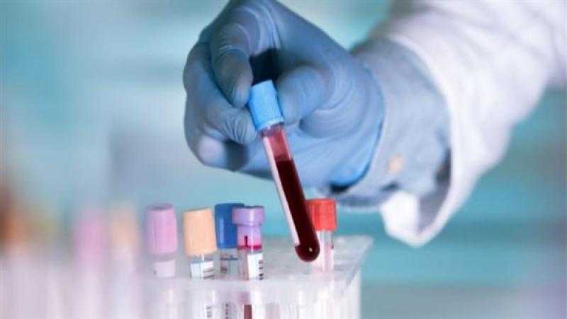 اكتشاف طريقة جديدة لعلاج سرطان الدم.. دراسات تكشف التفاصيل
