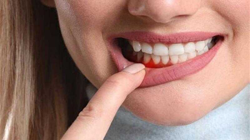 أمراض اللثة الشديدة تؤدي للإصابة بأكثر أنواع السرطان فتكًا