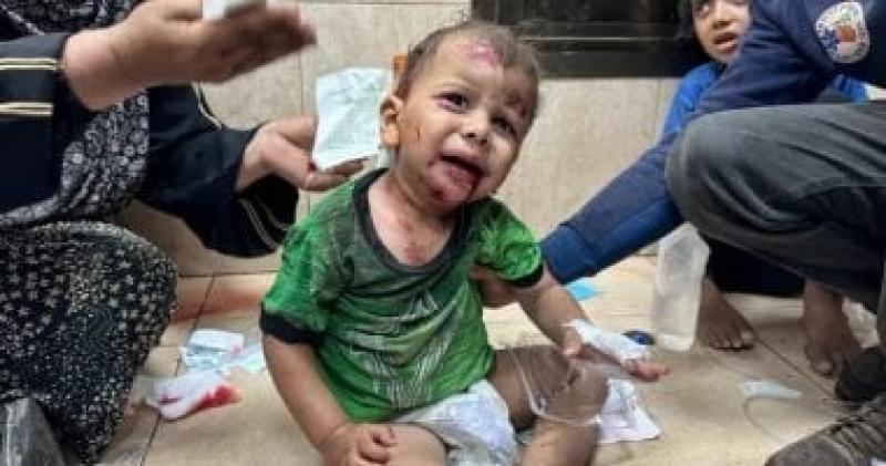 الصحة الفلسطينية: تسجيل أول حالة إصابة مؤكدة لفيروس شلل الأطفال في قطاع غزة