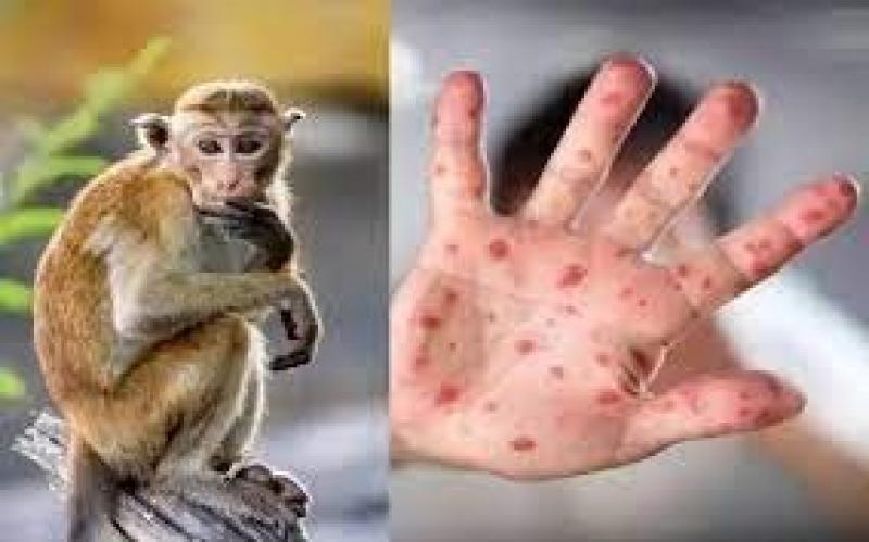 الكونغو: لا تأجيل للدراسة مع اتخاذ إجراءات للوقاية من جدرى القرود