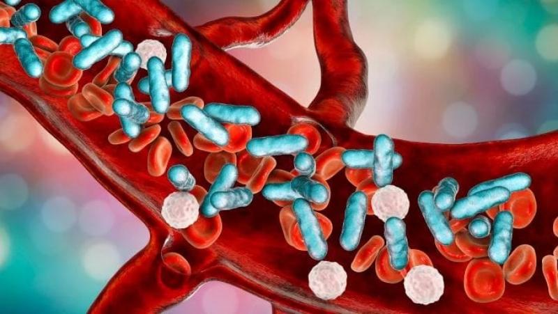 وزارة الصحة تكشف 8 علامات تشير للإصابة بتسمم الدم