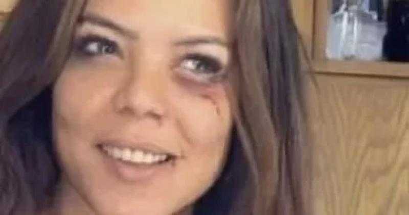 أحداث بالوسط الفني شغلت السوشيال ميديا.. صلح شيرين عبد الوهاب وكدمات ناهد السباعي وحقيقة اعتزال نشوى مصطفى