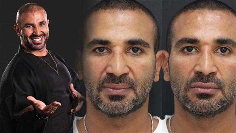 طبيب أحمد سعد يكشف تفاصيل حالته الصحية بعد عملية دقيقة