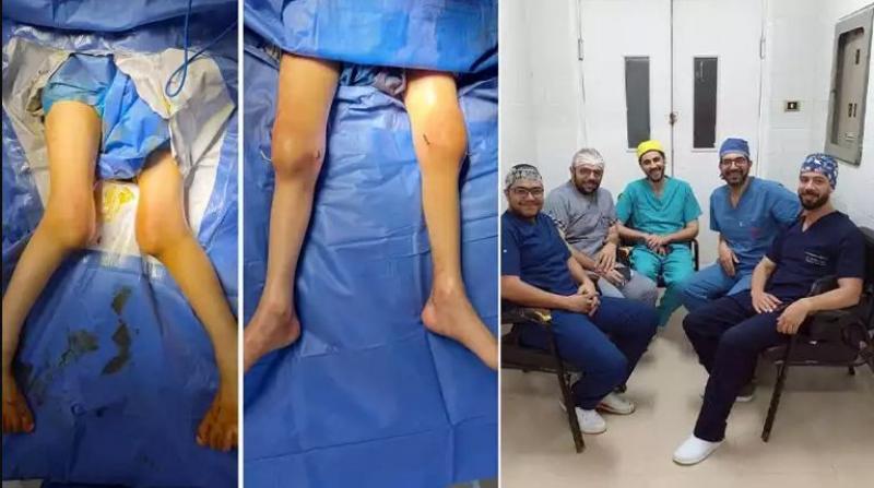 فريق طبي بالغربية يجري عملية ناجحة لتصحيح تقوس عظام لطفل عمره 5 سنوات