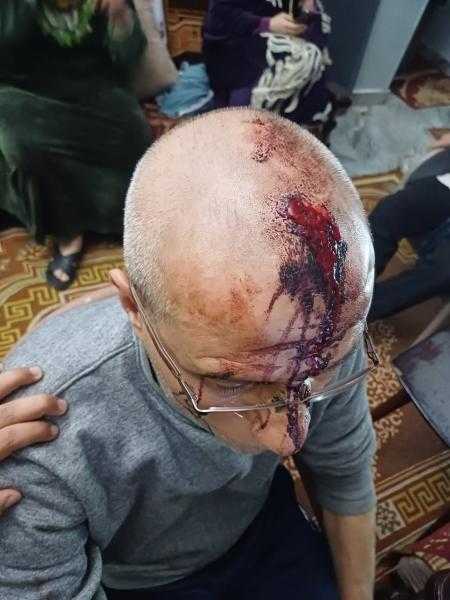 إشعال نيران بجوار كابينة كهرباء ينتهي بمحاولة قتل داخل مسجد بالقليوبية