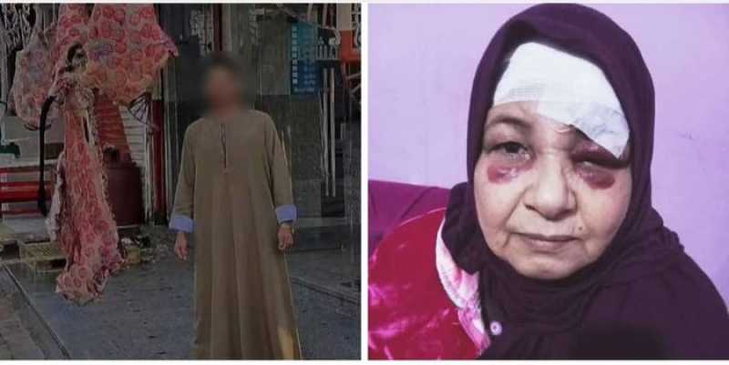 ضربها بالكارع.. القبض على جزار اعتدى على عاملة داخل مسمط بالإسماعيلية