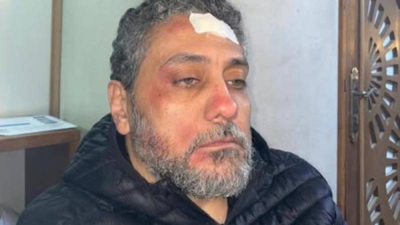 خط أحمر