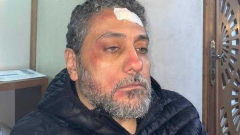 وحدة إضاءة وقعت عليه.. تامر فرج يتعرض لإصابة خطيرة خلال التصوير