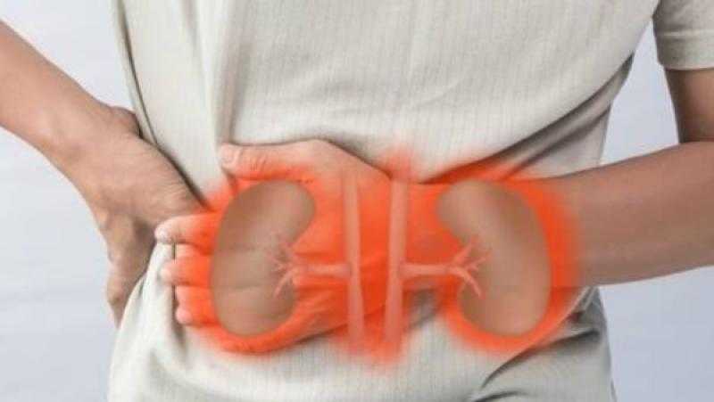 أستاذ جهاز هضمي: مرضى الفشل الكبدي والكلوي ممنوعون من الصيام