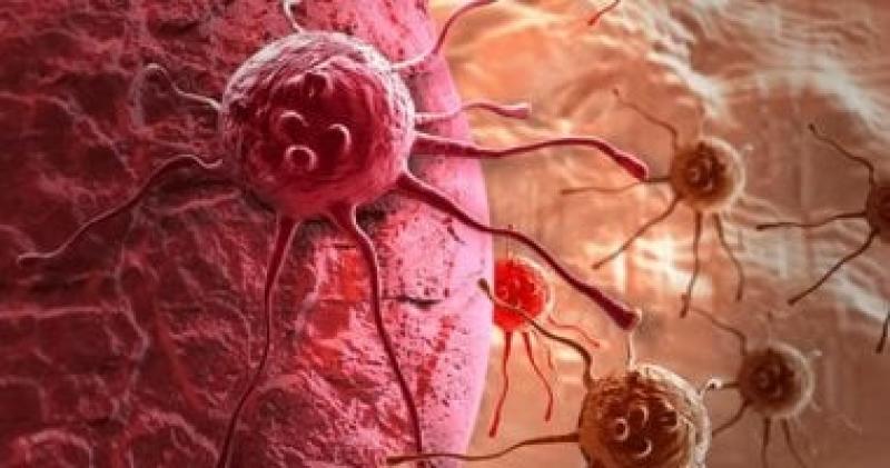 أهمية الكشف المبكر والفحص للوقاية من السرطان